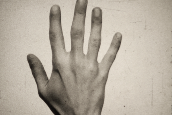 Fifth Metacarpal | Scott Fitzpatrick Fifth Metacarpal | Scott Fitzpatrick